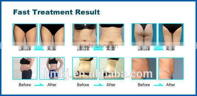 2015 high power 7 in 1 ultra sonic cavitation