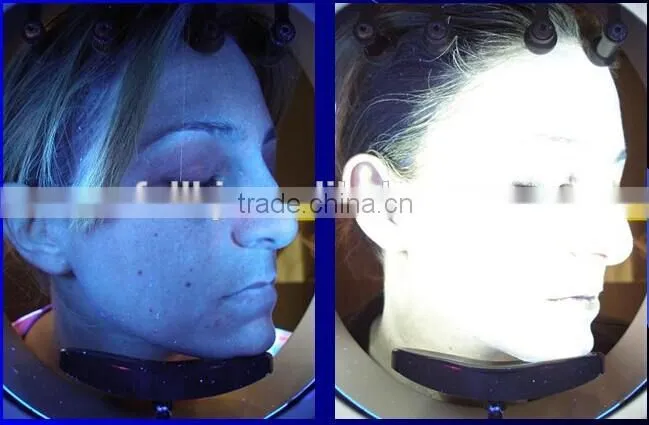 3D intelligent skin analyzer machine best selling skin analyzing equipment