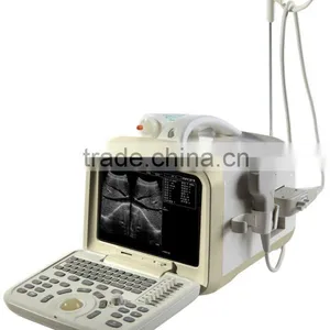 Ultrasound Scanner With Body Scanner thumbnail-1