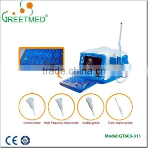 High Quality New Design Cheap Ultrasound Machine thumbnail-1