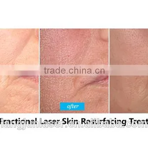 High Power 50w Co2 Laser Engraving and Cutting Machine thumbnail-2