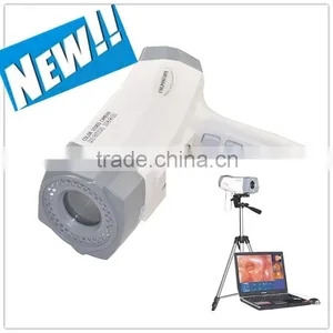 New Portable Digital Electronic Colposcope With CCD Sony Camera 800,000 Pixels With Analysis Software RCS-400 Model Manufacture thumbnail-1