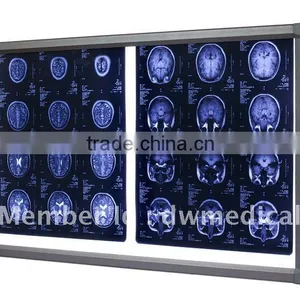 X Ray Medical Product thumbnail-1