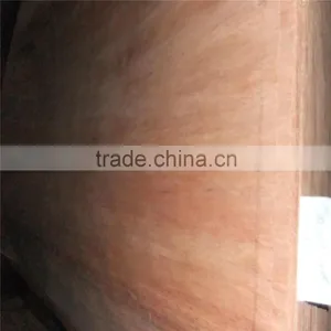 Gurjan Veneers thumbnail-1