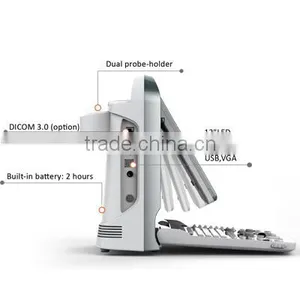 Portable Ultrasound Scanner Color Doppler Ultrasound System thumbnail-3