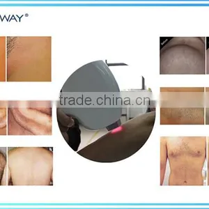 2016 Best Seller Painless and Permanent Depilator Professional 808 Home Use Diode Laser Hair Removal Device thumbnail-4