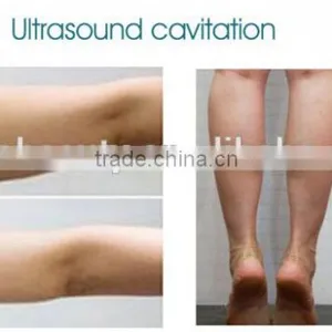 Professional High Intensity Focused Ultrasound Therapy Beauty Machine Weight Loss Machine Fat Burning Instrument thumbnail-5