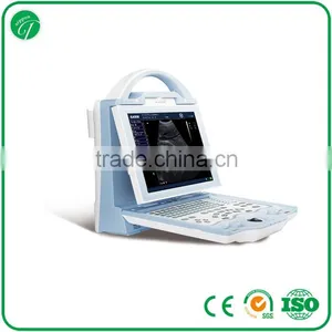 Hospital Equipment Laptop Ultrasound Machine/portable Ultrasound Scanner KX5600 thumbnail-1