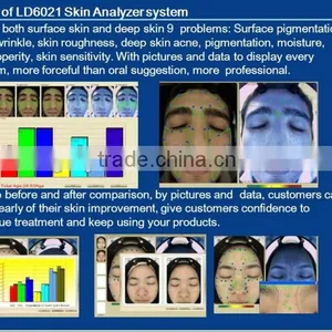 Chinese Magic Mirror Skin Moisture Animated Test Machine thumbnail-5