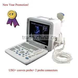 CE Approved Laptop/Portable Ultrasound Scanner With 3.5Mhz Multi-frequency Convex Probe thumbnail-1