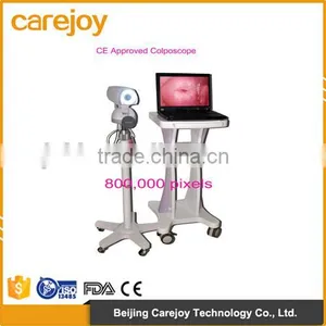 Factory Price Medical Gynaecology Device Digital Video Colposcope for Sale thumbnail-1