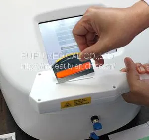 Portable IPL Laser thumbnail-5