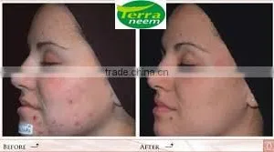 HIGH PURE COLD PRESSED TERRA NEEM OIL FROM INDIA thumbnail-5