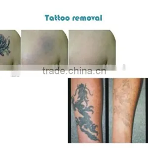 Portable Beauty Products Long Pulse Nd 1064nm Yag Laser /Easy Work Professional Laser Permanent Tattoo Removal thumbnail-4