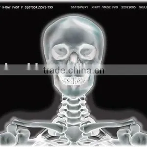 Imaging Medical Ray Film,digital X-ray Cr,fuji Dry Film With CE Sale From Manufacturer thumbnail-1