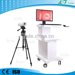 LT9802 Portable Digital Video Colposcope thumbnail-2