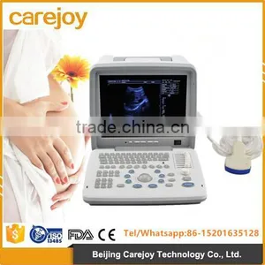 12-inch LCD Monitor Full Digital LED Portable Ultrasound Scanner Price thumbnail-1