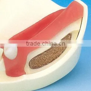 Typodont Orthodontic Model for Practicing Teeth Model Factory thumbnail-6