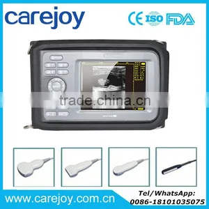 Carejoy Handheld Ultrasound Scanner HandScan H8 With 3.5 Mhz Convex Probe Suitable Carry/transporation Good Price thumbnail-1