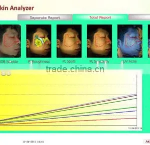 Skin Tester Professional Magic Mirror Skin Analyzer Skin Diagnostic Equipment thumbnail-2