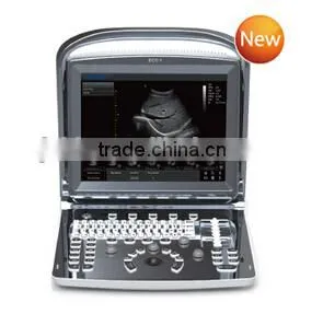 Promotion!!CE Approved Notebook/ Portable Chison USB Ultrasound Scanner With 3.5Mhz Multi-frequency Convex Probe ECO1 thumbnail-1