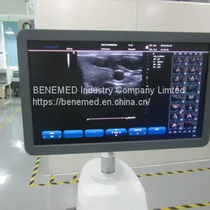 Trolly 2D Echocardiography Color Doppler Ultrasound Scanner Diagnosis Equipment thumbnail-4