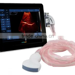 9.7 Inch Touchscreen Full Digital UpadScan Ultrasound Scanner With CE Approved thumbnail-2