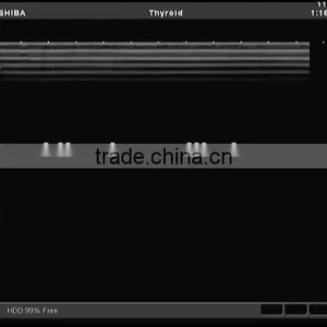 Used Toshiba Ultrasound Linear Probe PLT-805AT Doppler Color Transducer thumbnail-4