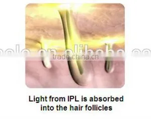 New Technolgoy Apolomed HS-350E Spa Shr Ipl Hair Removal thumbnail-6