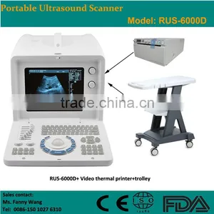 Digital Portable Ultrasound Scanner thumbnail-1