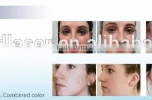 Spot Removal Professional PDT LED Light For Skin Rejuvenation Beauty Salon Wrinkle Removal thumbnail-6
