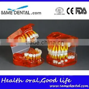 Bicolor Deciduous Teeth Development Model 1Teaching Demonstration Models thumbnail-1