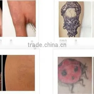 Distributor Wanted Most Effective Mini Picosecond Laser Tattoo Removal Machine With Sale Price thumbnail-5
