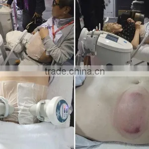 Body Shaping Machine/ Cool Slimming Machine/ Cool Tech Fat Freezing Machine thumbnail-6