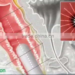 High Quality Hifu Vaginal No Pain Tightening Machine For Vagina Rejuvenation Nasolabial Folds Removal thumbnail-4
