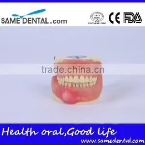 Dental Surgical Integrated Model Teaching Demonstration Teeth Model thumbnail-1