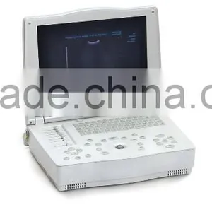 Hospital Clinical Equipment 15-inch Full Digital Laptop Ultrasound Scanner China Made Portable Ultrasound Machine thumbnail-2
