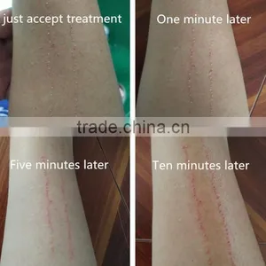 Hori Naevus Removal Best Tattoo Removal Laser Machine/ Q Switch Varicose Veins Treatment Nd Yag Laser Hair And Tattoo Removal Machine/cheap Tattoo Removal thumbnail-3