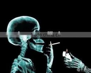 Quit Stop Smoking Laser / Cold Laser/ Lowlevel Laser Therapy thumbnail-5