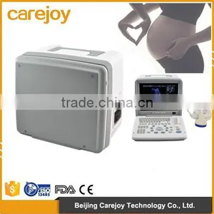 High Performance Low Price Portable Mini Ultrasound Machine for Sale thumbnail-1