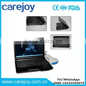 Carejoy Laptop Ultrasound Machine Ultrasonic Diagnostic System RUS-9000F With CE Certification thumbnail-1