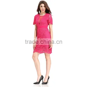 Fashion Lace Patchwork Short Frock Lady Image Skater Dress thumbnail-4