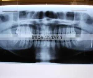 China Medical x Ray Dental Film With ISO 13485 and CE thumbnail-1