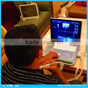 C7 KONTED 3D Portable Color Doppler Ultrasound Machine thumbnail-1