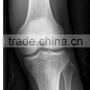 KND X-ray Film Medical Supply Fuji X100 Type With CE thumbnail-1