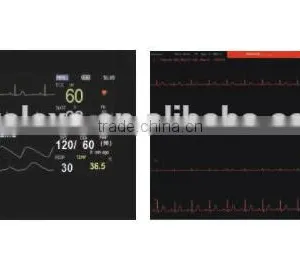 Multiparameter Ambulance Patient Monitor thumbnail-6