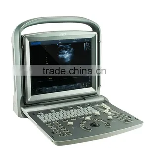 China Cheap Price USB Portable Laptop Color Doppler Ultrasound Scanner for Pregnancy Scanner Ultrasound thumbnail-4