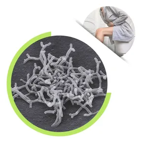 Bulk Bifidobacterium Longum Probiotics Powder Improve Digestive System thumbnail-1