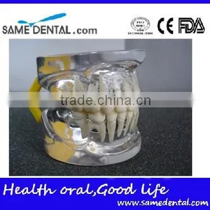 Transparant Deciduous Teeth Model Teaching And Hospital Demonstration thumbnail-2