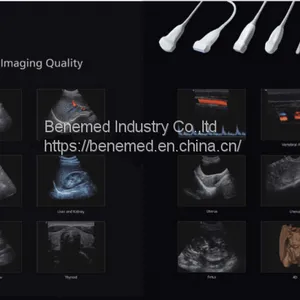 Portable 4D Color Doppler Ultrasound Scanner BENE-3V thumbnail-4